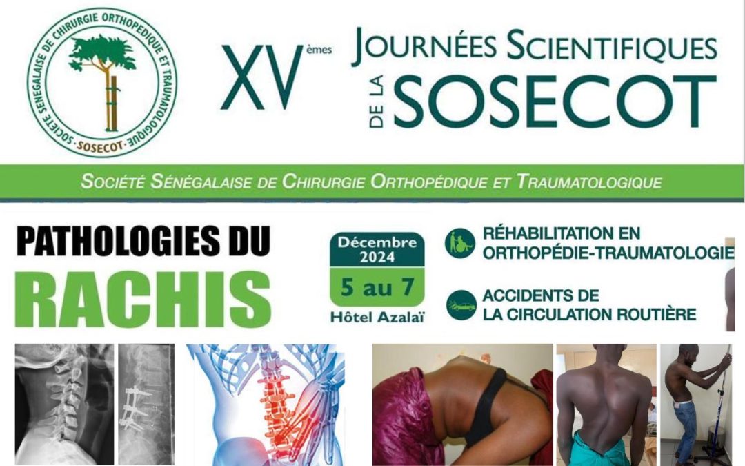 15ème journée scientifique de la SOSECOT